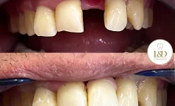 стоматологическая клиника line dental изображение 9 на проекте infodoctor.ru